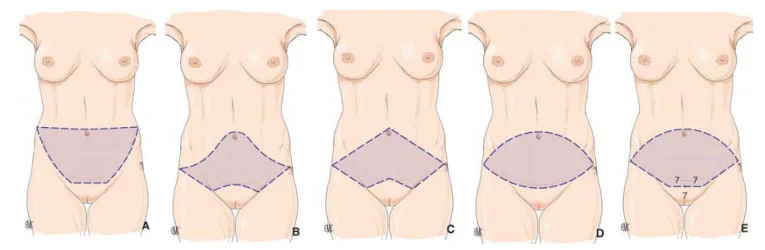 Illustration anatomique ou technique extraite de la thèse