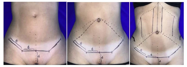 Illustration anatomique ou technique extraite de la thèse