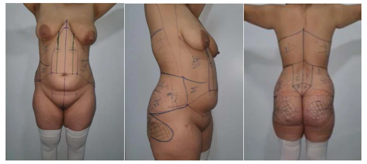 Illustration anatomique ou technique extraite de la thèse