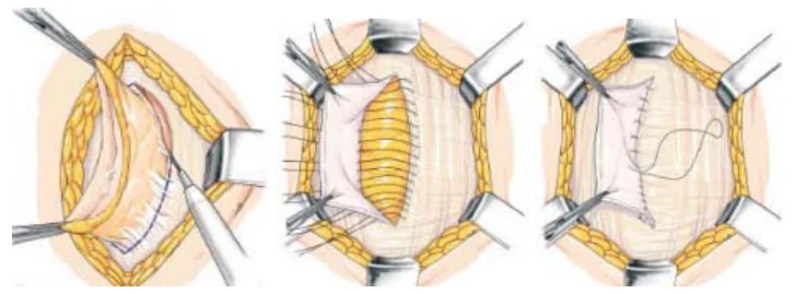 Illustration anatomique ou technique extraite de la thèse
