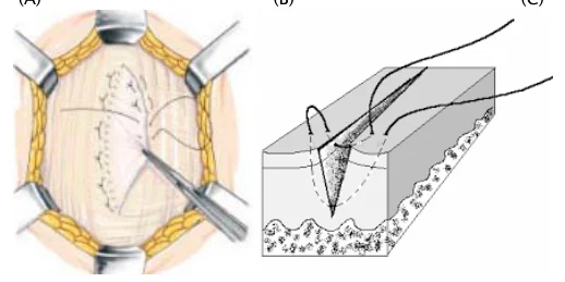 Illustration anatomique ou technique extraite de la thèse