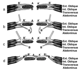 Illustration anatomique ou technique extraite de la thèse