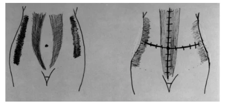 Illustration anatomique ou technique extraite de la thèse