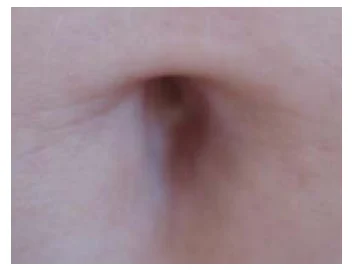 Illustration anatomique ou technique extraite de la thèse