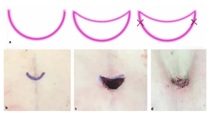Illustration anatomique ou technique extraite de la thèse