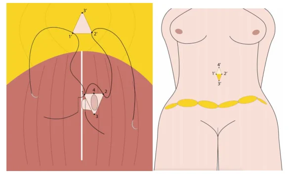Illustration anatomique ou technique extraite de la thèse
