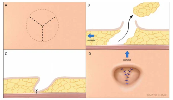 Illustration anatomique ou technique extraite de la thèse