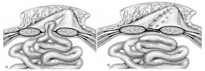 Illustration anatomique ou technique extraite de la thèse
