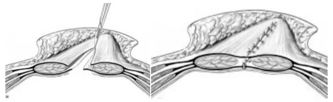 Illustration anatomique ou technique extraite de la thèse