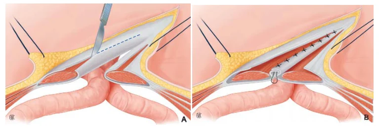 Illustration anatomique ou technique extraite de la thèse