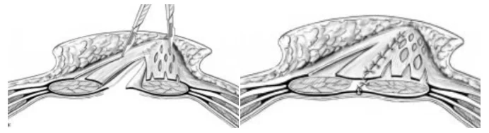 Illustration anatomique ou technique extraite de la thèse