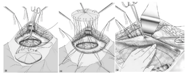 Illustration anatomique ou technique extraite de la thèse