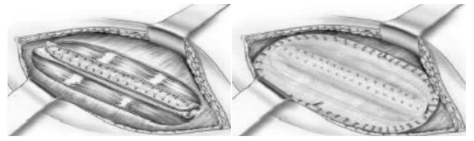 Illustration anatomique ou technique extraite de la thèse