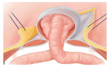 Illustration anatomique ou technique extraite de la thèse