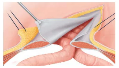 Illustration anatomique ou technique extraite de la thèse