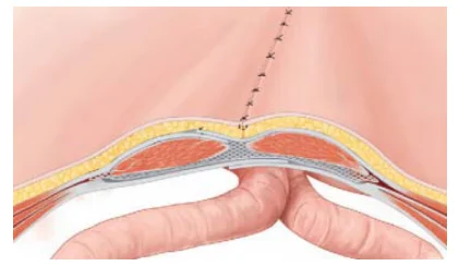 Illustration anatomique ou technique extraite de la thèse