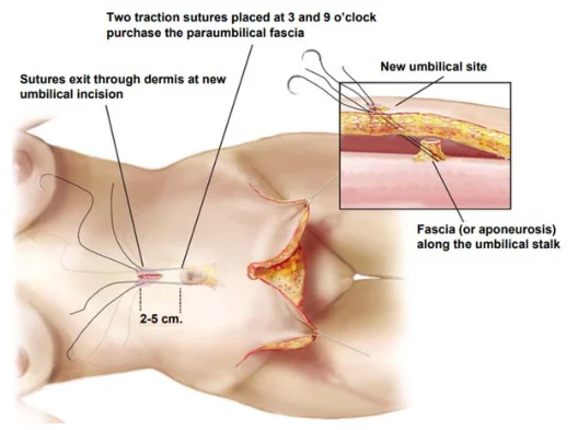 Illustration anatomique ou technique extraite de la thèse