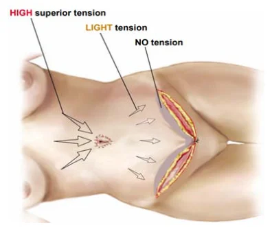 Illustration anatomique ou technique extraite de la thèse
