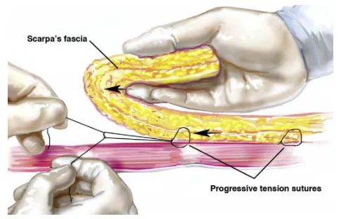 Illustration anatomique ou technique extraite de la thèse