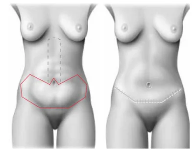 Illustration anatomique ou technique extraite de la thèse