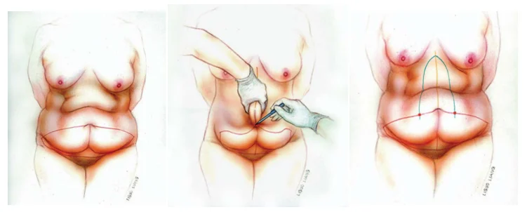 Illustration anatomique ou technique extraite de la thèse