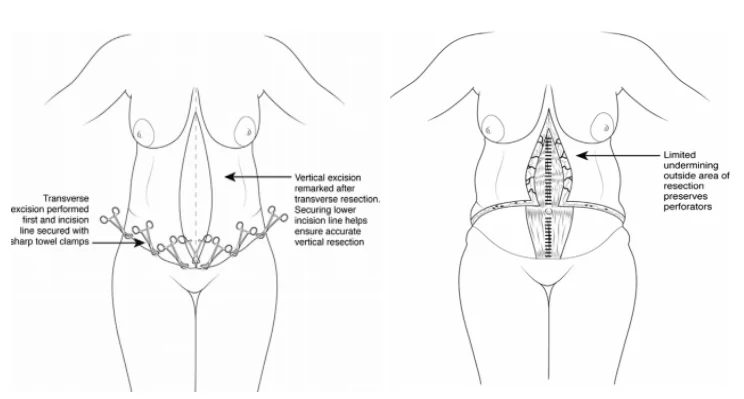 Illustration anatomique ou technique extraite de la thèse