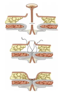 Illustration anatomique ou technique extraite de la thèse