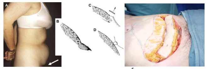 Illustration anatomique ou technique extraite de la thèse
