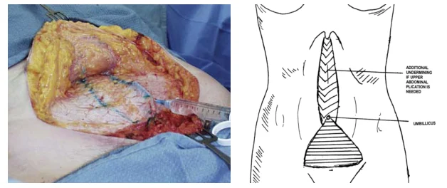 Illustration anatomique ou technique extraite de la thèse