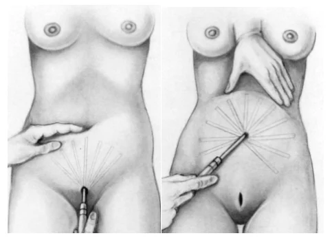 Illustration anatomique ou technique extraite de la thèse