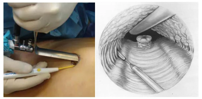 Illustration anatomique ou technique extraite de la thèse