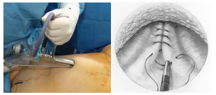 Illustration anatomique ou technique extraite de la thèse