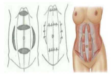 Illustration anatomique ou technique extraite de la thèse