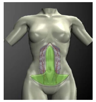 Illustration anatomique ou technique extraite de la thèse