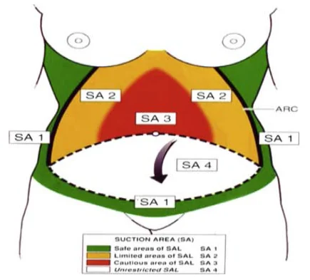 Illustration anatomique ou technique extraite de la thèse
