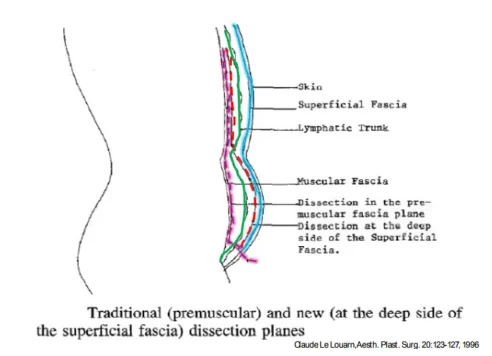 Illustration anatomique ou technique extraite de la thèse