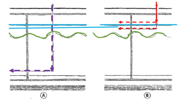 Illustration anatomique ou technique extraite de la thèse