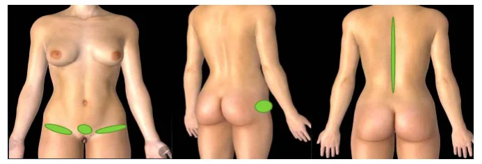 Illustration anatomique ou technique extraite de la thèse