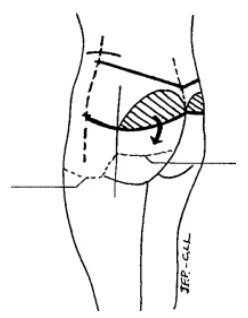 Illustration anatomique ou technique extraite de la thèse