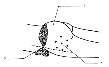 Illustration anatomique ou technique extraite de la thèse
