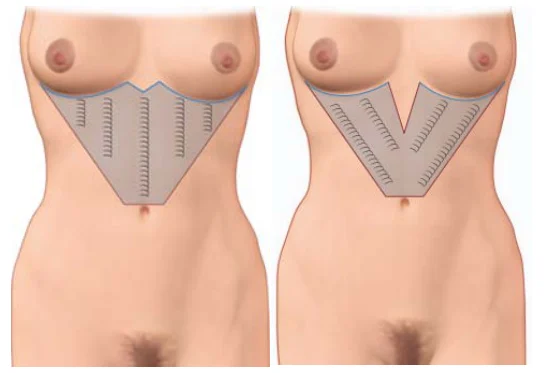 Illustration anatomique ou technique extraite de la thèse