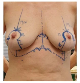 Illustration anatomique ou technique extraite de la thèse