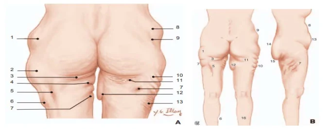 Illustration anatomique ou technique extraite de la thèse