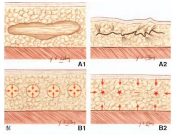 Illustration anatomique ou technique extraite de la thèse