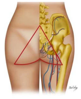 Illustration anatomique ou technique extraite de la thèse