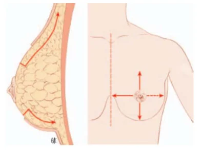 Illustration anatomique ou technique extraite de la thèse