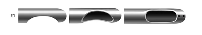 Illustration anatomique ou technique extraite de la thèse