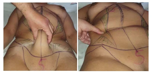 Illustration anatomique ou technique extraite de la thèse