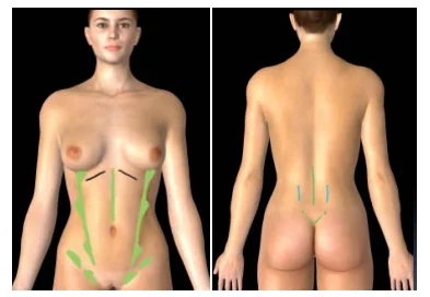 Illustration anatomique ou technique extraite de la thèse
