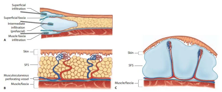 Illustration anatomique ou technique extraite de la thèse